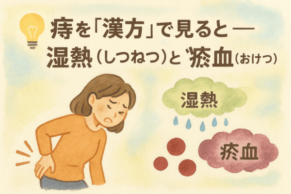 痔を漢方で“湿熱”と“瘀血”から説明する水彩画風イラスト。おしりの痛みで前かがみになり、腰を押さえる女性が描かれ、いぼ痔・切れ痔の原因となる炎症（湿熱）と血流停滞（瘀血）を象徴する雲のアイコンが配置されている。妊活中の女性や山形の寒冷地で血流が悪くなりやすい人に多い痔の症状を、漢方では体質から整えて改善するという内容を伝える説明画像。外用だけでなく、体の内側からアプローチする漢方治療の重要性を強調している。