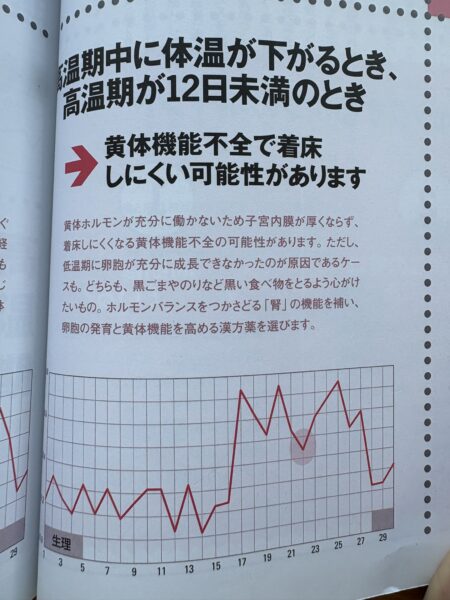 高温期の途中で体温が下がり、12日未満で短く終わっている基礎体温表のイラスト。グラフの高温期が途中で下降し、黄体機能不全によって着床しにくい状態を表現している。