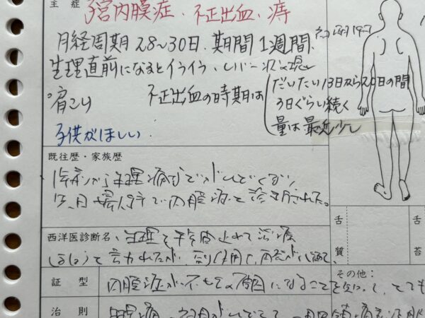 子宮内膜症による生理痛・不正出血・レバー状の塊・肩こりなどに悩む25歳女性の体験談の文章が写された写真。月経周期28〜30日、月経期間1週間、強い生理痛で鎮痛剤が欠かせず、婦人科で子宮内膜症と診断された経緯が記されている。不妊や妊活への不安もつづられた記録。