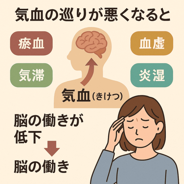 中医学における脳疲労の仕組みを示した図。気血（きけつ）が脳へ十分に巡らないと、瘀血・血虚・気滞・痰湿が起こり、脳の働きが低下することを説明している。頭を押さえる女性のイラストと、脳へ向かう気血の矢印、4つの体質要因（瘀血・血虚・気滞・痰湿）が表示され、気血不足が不調の原因になる様子を視覚的に表した。
