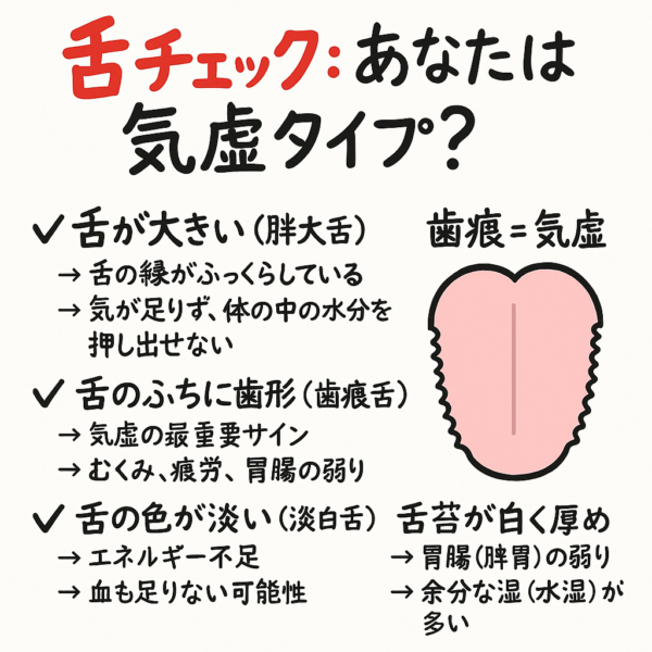 気虚体質を舌で判断する方法を説明する水彩イラスト。むくんで大きい舌、周囲に歯形(歯痕)がついた舌、淡い色の舌、白い舌苔が多い舌など、気虚に特徴的な舌の状態をわかりやすく示し、“舌は体質を映す鏡”というメッセージを添えた画像。