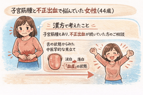 子宮筋腫による不正出血に悩んでいた44歳女性の漢方相談例をイラストで解説。舌の状態から血虚と判断し、中医学的な視点で体調の変化を示した図。
