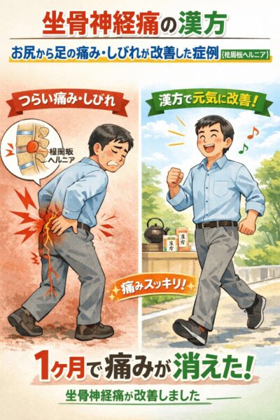 坐骨神経痛の漢方｜お尻から足の痛み・しびれが改善した症例【椎間板ヘルニア】
